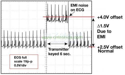 1.5 英尺以外的發射器（f = 470 MHz, P= 0.5W）開啟和關閉時ECG 診斷設備的心髒檢查結果