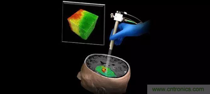 解讀光學相幹層析成像技術