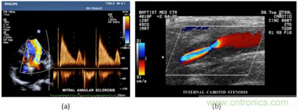 超聲係統的信號鏈設計注意事項