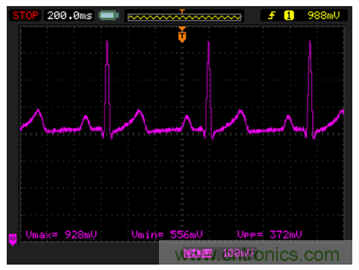微功耗IC免除心率監護儀的後顧之憂