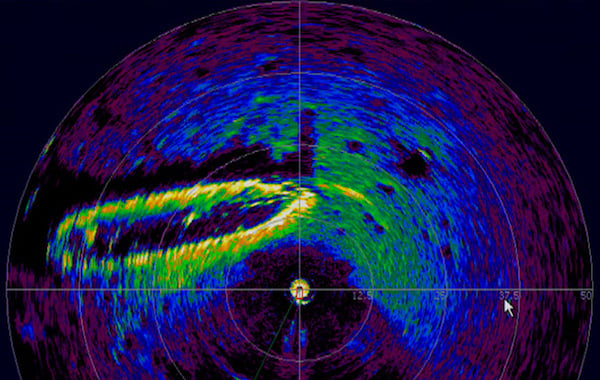 什麼是激光雷達以及如何使用它？