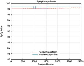 動態離散周期變換技術突破：無ECG參考的生理信號精準解析